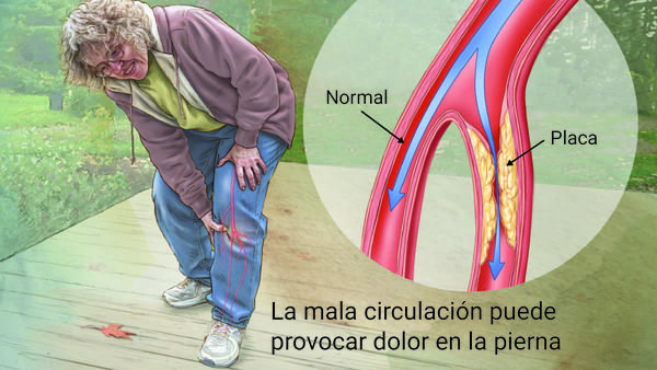 Evaluación vascular